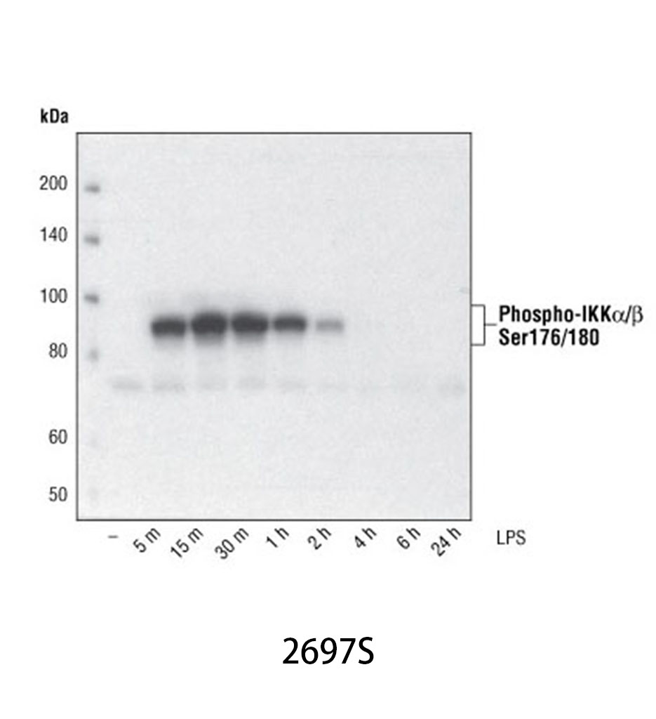 Phospho-IKKα/β (Ser176/180) (16A6) Rabbit mAb