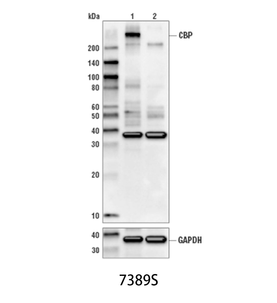 CBP (D6C5) Rabbit mAb