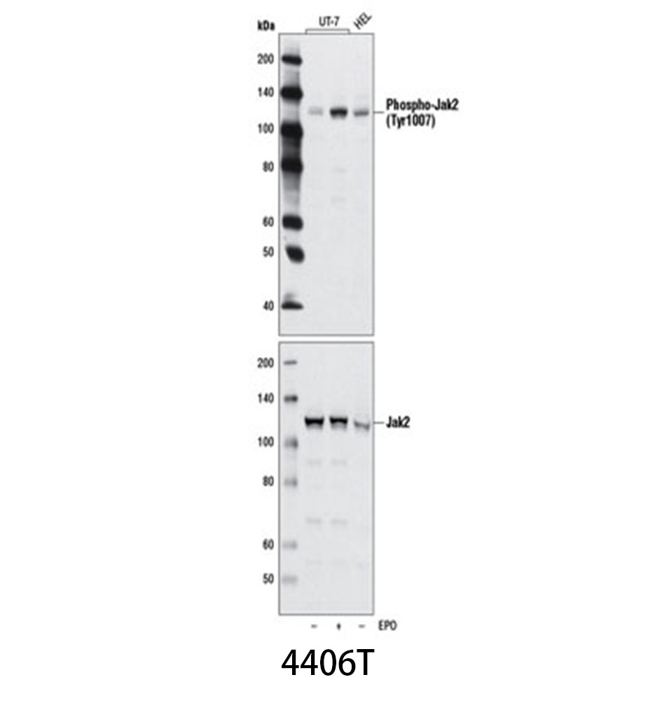Phospho-Jak2 (Tyr1007) (D15E2) Rabbit mAb