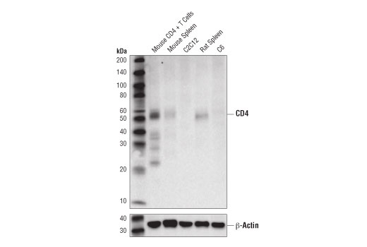 CD4 (D7D2Z) Rabbit mAb