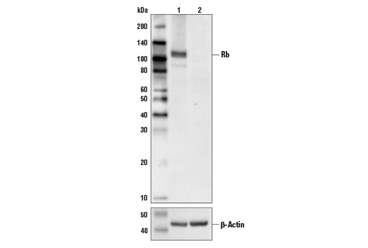 Rb (4H1) Mouse mAb