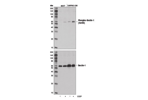 AMPK Substrate Antibody Sampler Kit