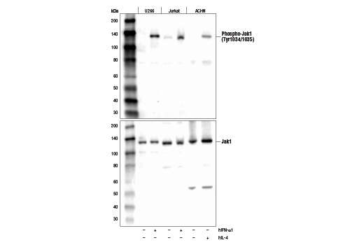 Phospho-Jak1(Tyr1034/1035) (D7N4Z) Rabbit mAb
