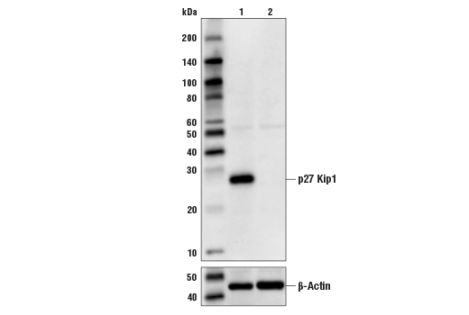p27 Kip1 (D69C12) XP Rabbit mAb