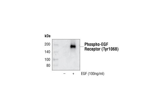 Phospho-EGF Receptor (Tyr1068) Antibody