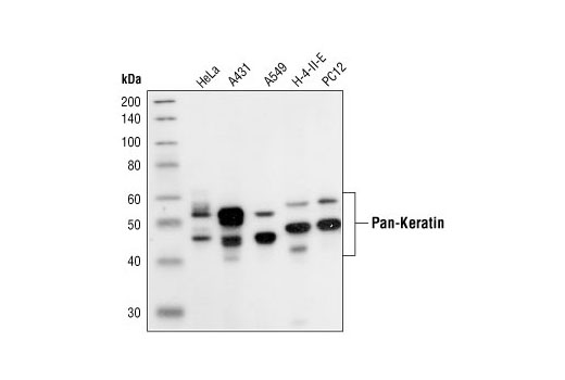 Pan-Keratin (C11) Mouse mAb