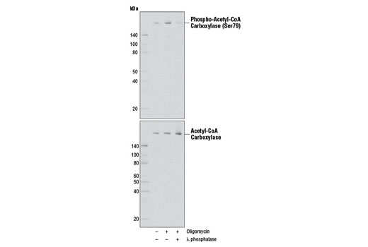 Fatty Acid and Lipid Metabolism Antibody Sampler Kit