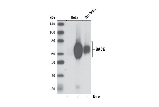 BACE (D10E5) Rabbit mAb