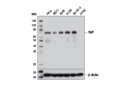 YAP (1A12) Mouse mAb
