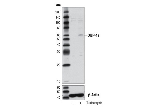 XBP-1s (D2C1F) Rabbit mAb