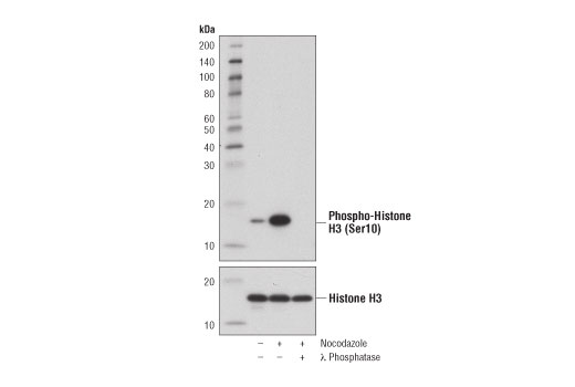 Phospho-Histone H3 (Ser10) (D7N8E) XP Rabbit mAb