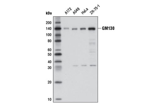 GM130 (D6B1) XPRabbit mAb