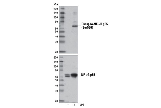 Phospho-NF-κB p65 (Ser536) (E1Z1T) Mouse mAb