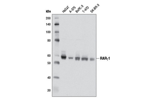 RARγ1 (D3A4) XP Rabbit mAb