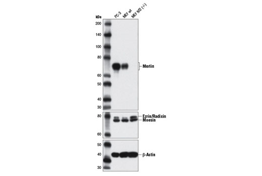 Merlin (D3S3W) Rabbit mAb