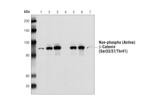 Non-phospho (Active) β-Catenin (Ser33/37/Thr41) Antibody