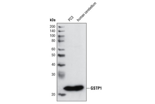 GSTP1 (3F2) Mouse mAb