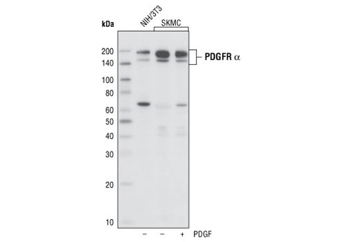 PDGF Receptor α (D1E1E) XP Rabbit mAb