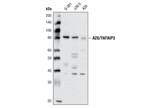 A20/TNFAIP3 (D13H3) Rabbit mAb