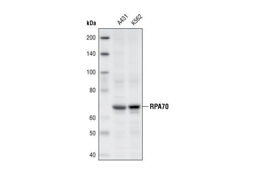 RPA70/RPA1 Antibody