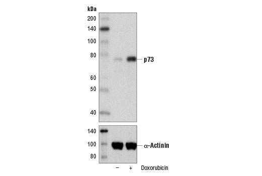 p73 (D3G10) Rabbit mAb