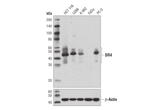 DR4 (D9S1R) Rabbit mAb