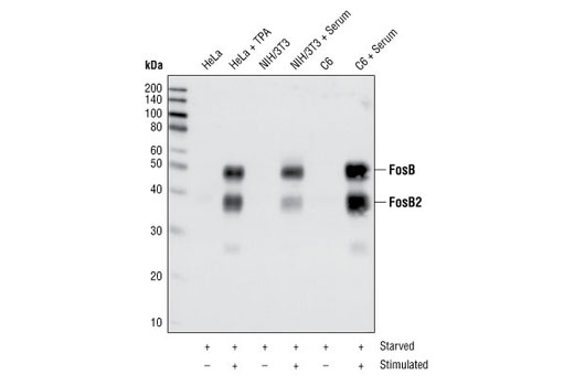 Fos Family Antibody Sampler Kit