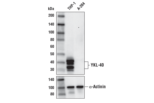 YKL-40 (E2L1M) Rabbit mAb