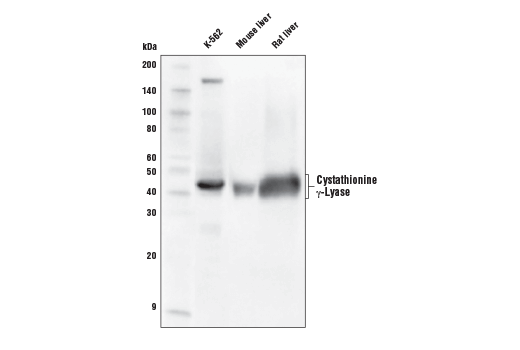 Cystathionine γ-Lyase (D1N1D) Rabbit mAb