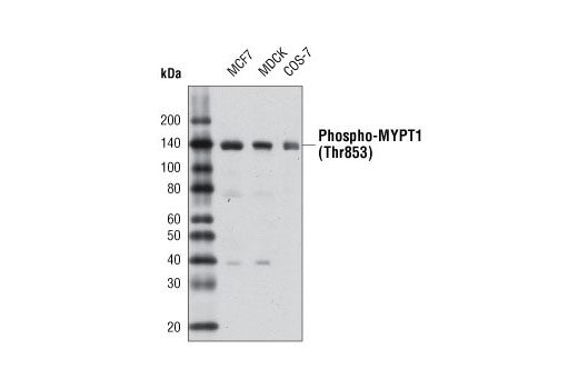 Phospho-MYPT1 (Thr853) Antibody