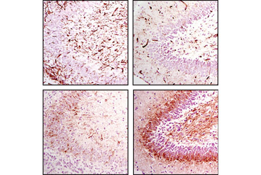 Nestin (Rat-401) Mouse mAb