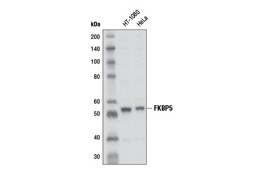 FKBP5 (D5G2) Rabbit mAb