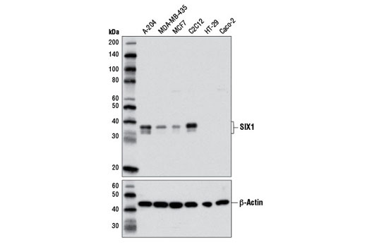 SIX1 (D4A8K) Rabbit mAb