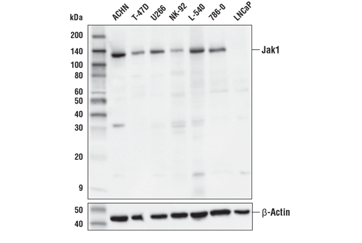 Jak1 (E3A6M) Rabbit mAb