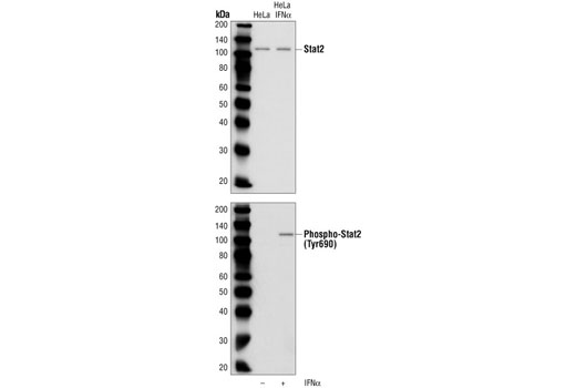 Phospho-Stat2 (Tyr690) Antibody