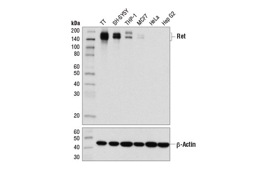 Ret (E1N8X) XP Rabbit mAb