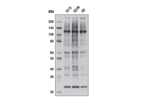 Phospho-CDK Substrate Motif [(K/H)pSP] MultiMab Rabbit mAb mix