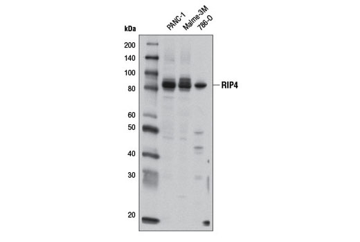 RIP4 Antibody