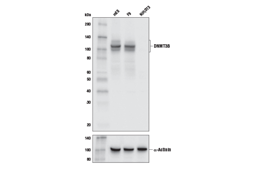 DNMT3B (E9X7R) Rabbit mAb (Mouse Specific)