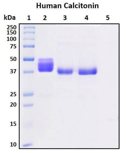 Recombinant Human Calcitonin (CT)
