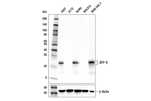 ATF-3 (E9J4N) Rabbit mAb