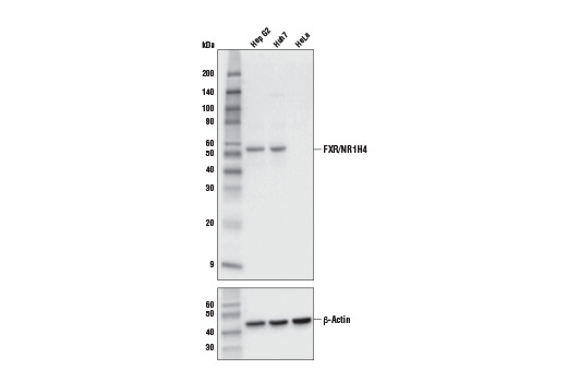 FXR/NR1H4 (E4B8P) Mouse mAb