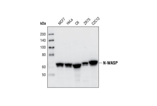 N-WASP (30D10) Rabbit mAb