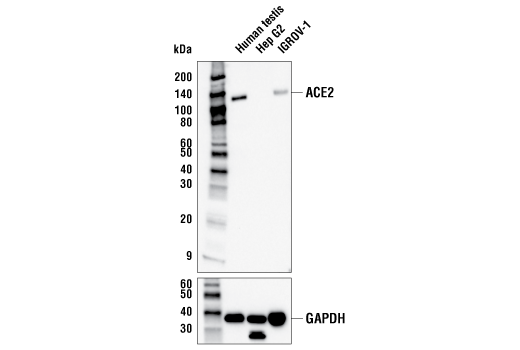ACE2 (OTI1D6) Mouse mAb