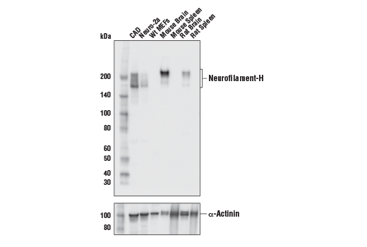 Neurofilament-H Antibody
