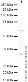 Anti-Aromatase antibody