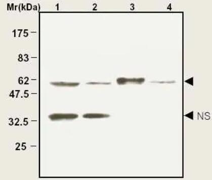 Anti-Catalase抗体- Peroxisome Marker