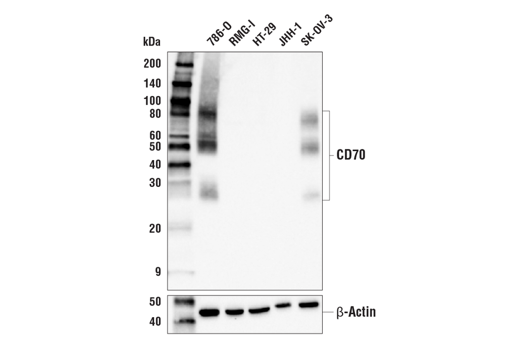 CD70 (E3Q1A) Rabbit mAb