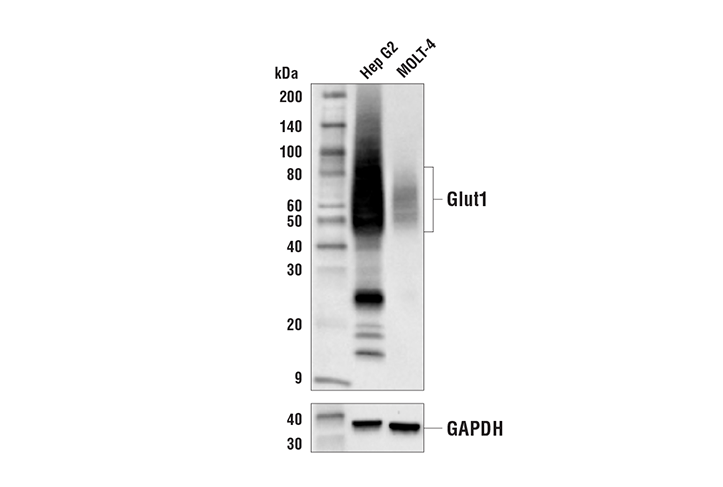 Glut1 (E4S6I) Rabbit mAb
