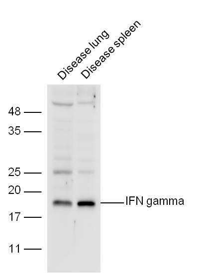 干扰素-r/IFN-r抗体